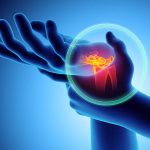 Wrist painful - skeleton x-ray, 3D Illustration medical concept. Wrist painful - skeleton x-ray, 3D Illustration medical concept.